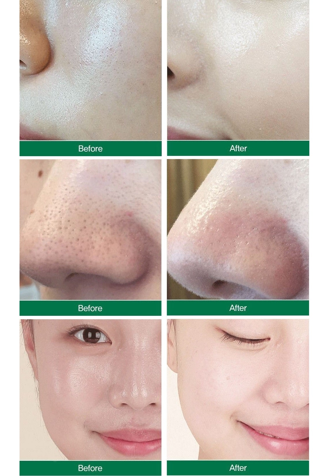 1回の洗顔で毛穴をきれいにお掃除 顔にある2万個の毛穴をきれいに