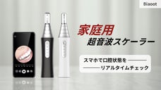 いつでも口腔を清潔でキレイに保つ！家庭用超音波スケーラー「Biaoot」登場！