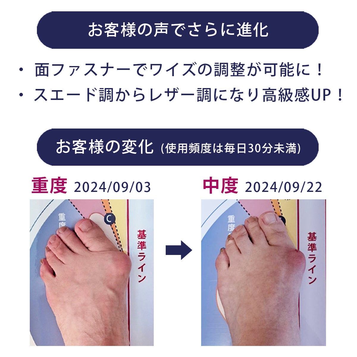 Makuake｜“ながら時間”で効率よく運動できる足トレスリッパ「グーパー