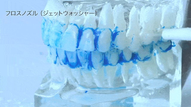 ジェット水流と音波振動の同時洗浄 】全ての汚れを1台で、1度に