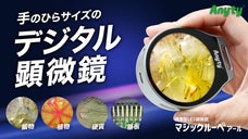 見る・撮る・残す！小さな異常や美しさも逃さず観察・記録できる手のひらサイズ顕微鏡