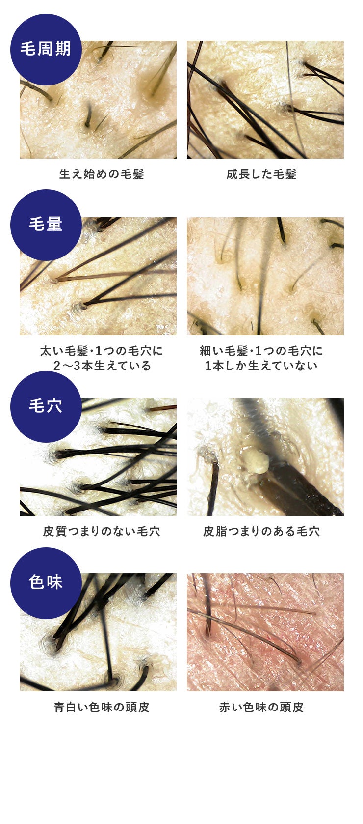 毛髪・毛穴・お肌の変化をスマホで確認！毎日のケアを楽しくする