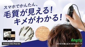 毛髪・毛穴・お肌の変化をスマホで確認！毎日のケアを楽しくするマイクロスコープ