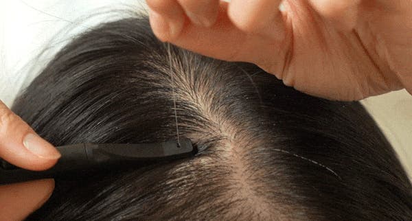 アンコール】気になる白髪、もう抜かない。頭皮にやさしい新発想の白髪
